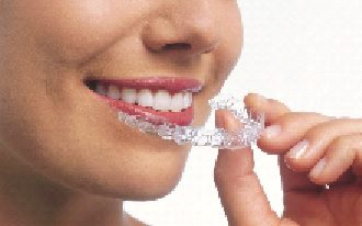 invisalign