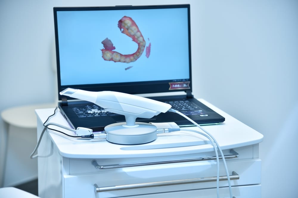 Dental,Intraoral,3d,Scanner,And,Laptop,On,Table,In,Dentist