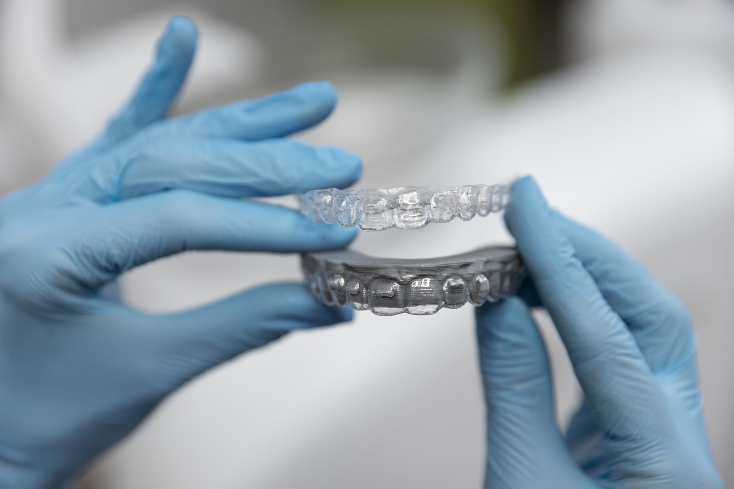 Clear Aligners