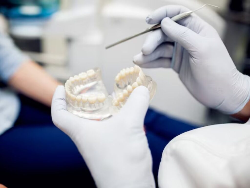 Dental Bridges
