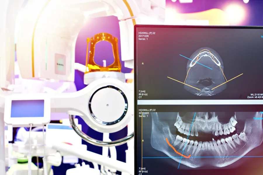 Digital X-Rays