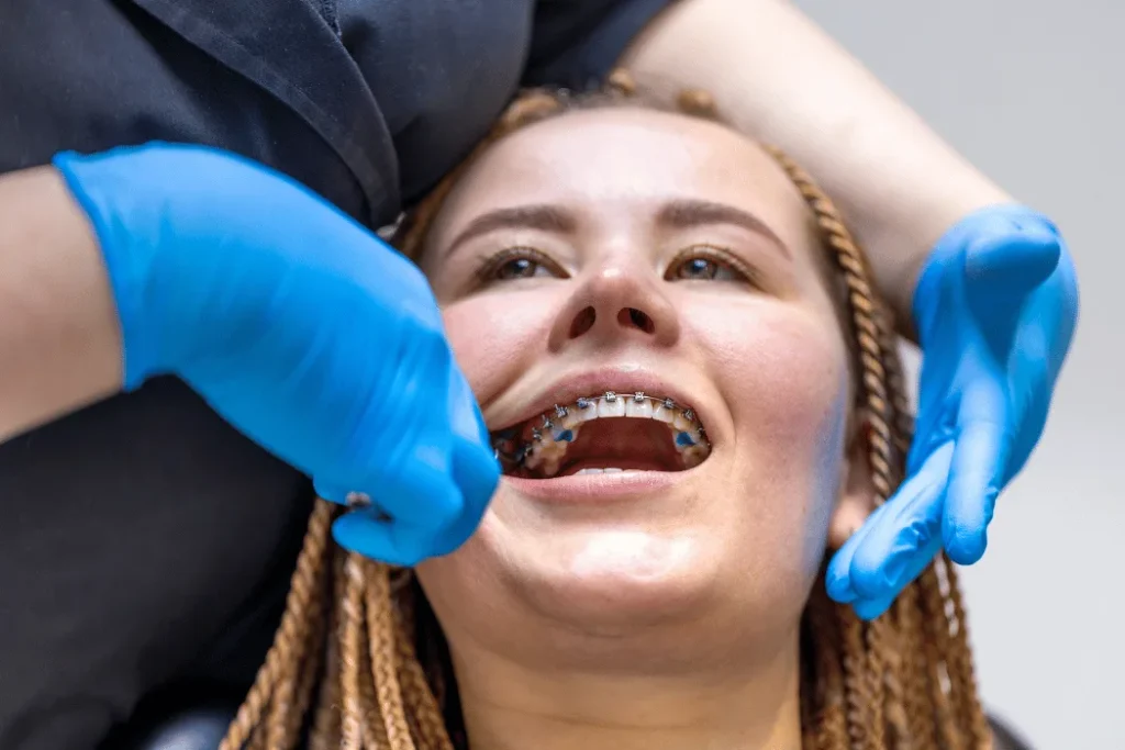 Teeth Straightening Banner 3
