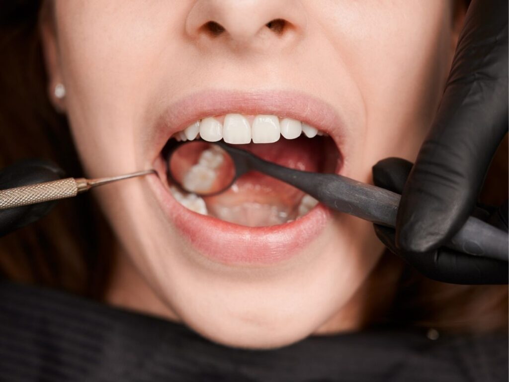 What Should Tumwater Patients Expect During Their First Periodontal Cleaning