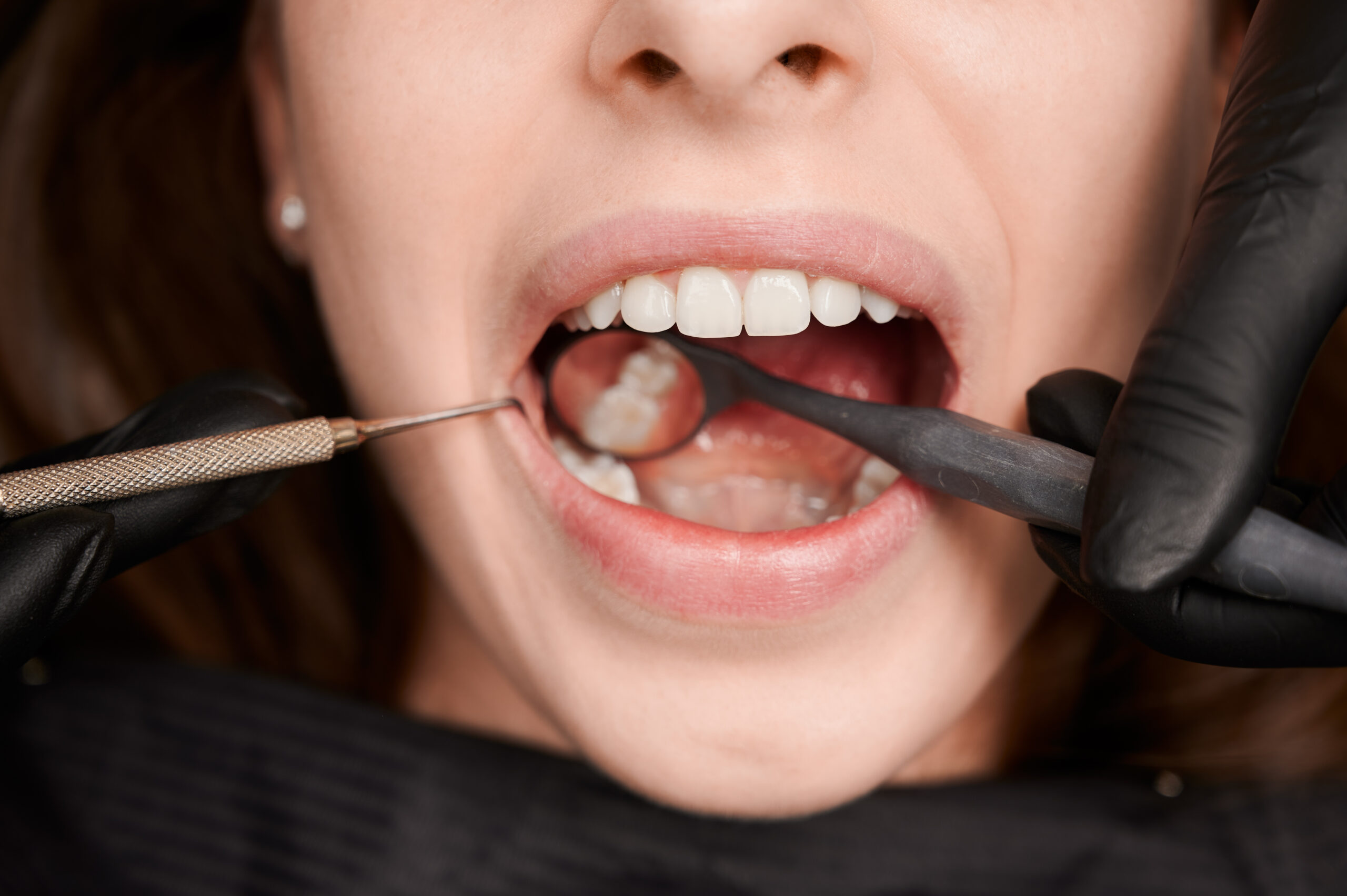 What Should Tumwater Patients Expect During Their First Periodontal Cleaning