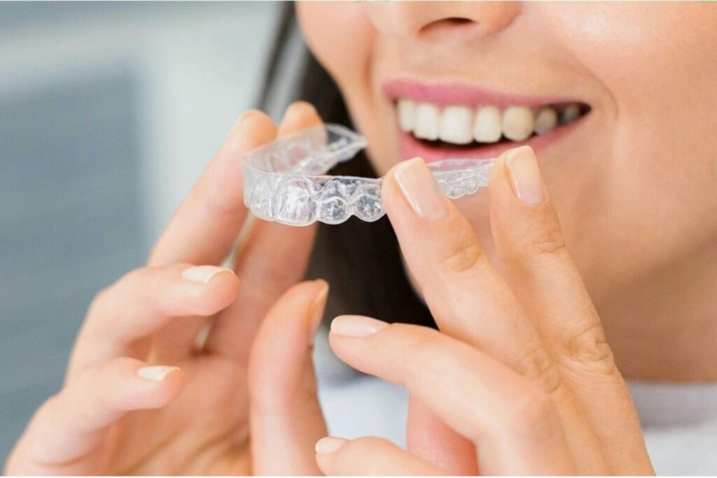 Clear aligners Tumwater