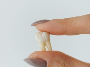 Tooth Extraction & Wisdom Teeth