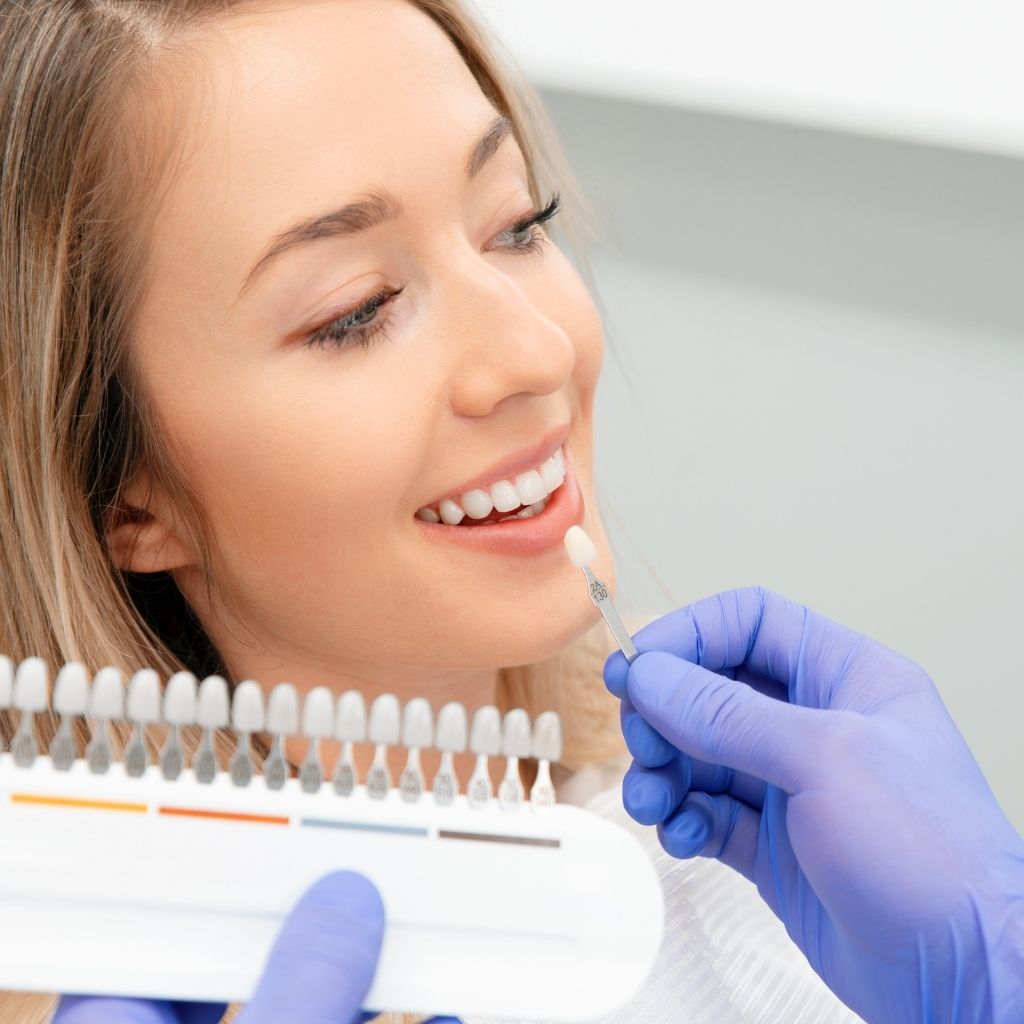 veneer bonding