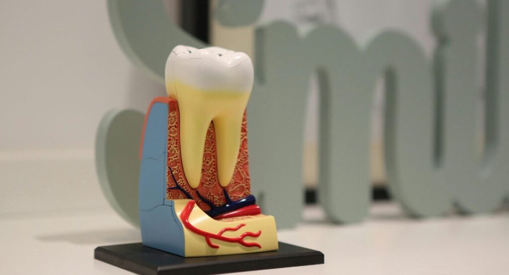 Root Canal Therapy