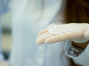 Clear Aligners
