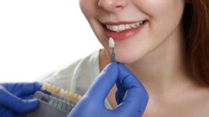 Dental Veneers 